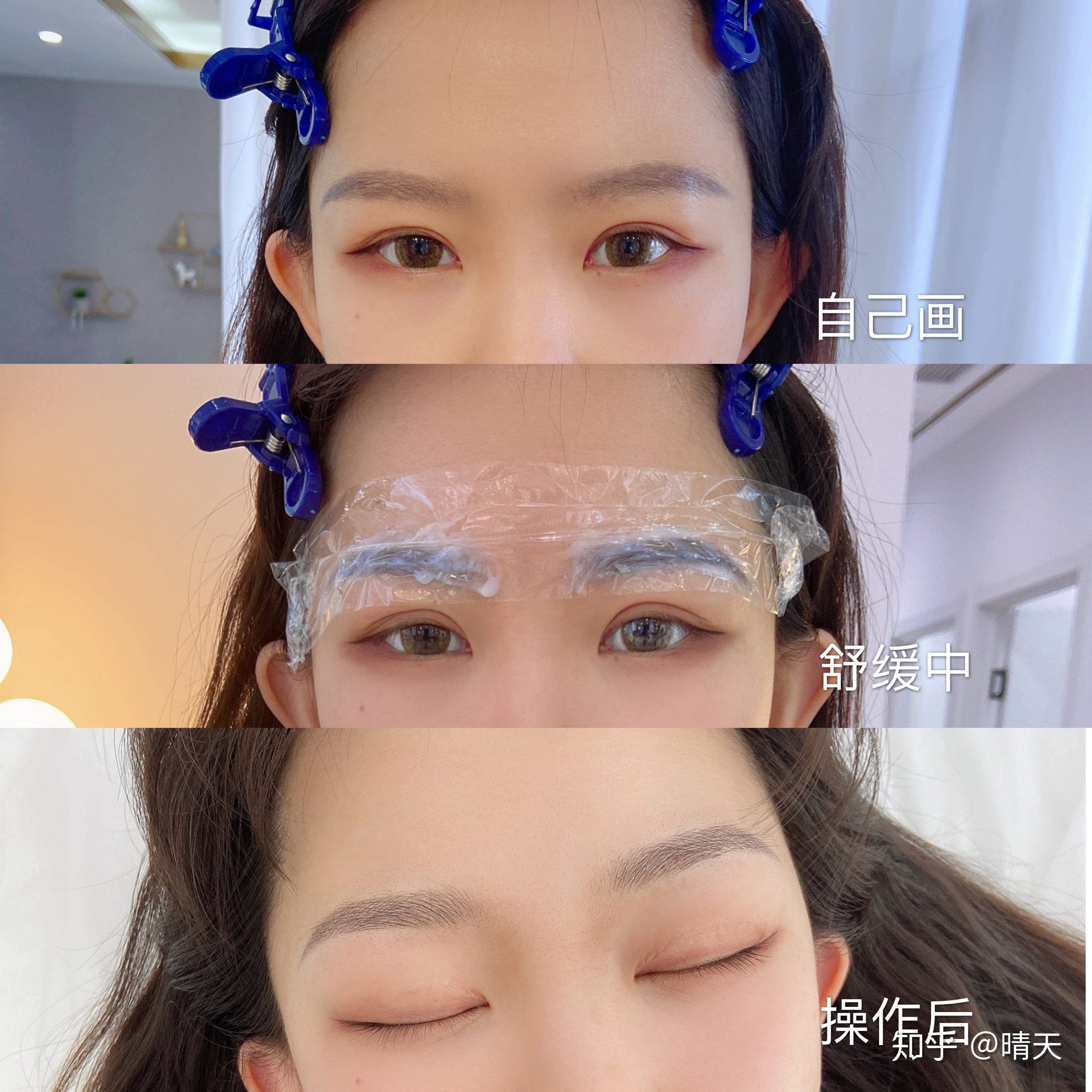 李贝儿自然眉丨韩式半永久化妆对皮肤有伤害吗?