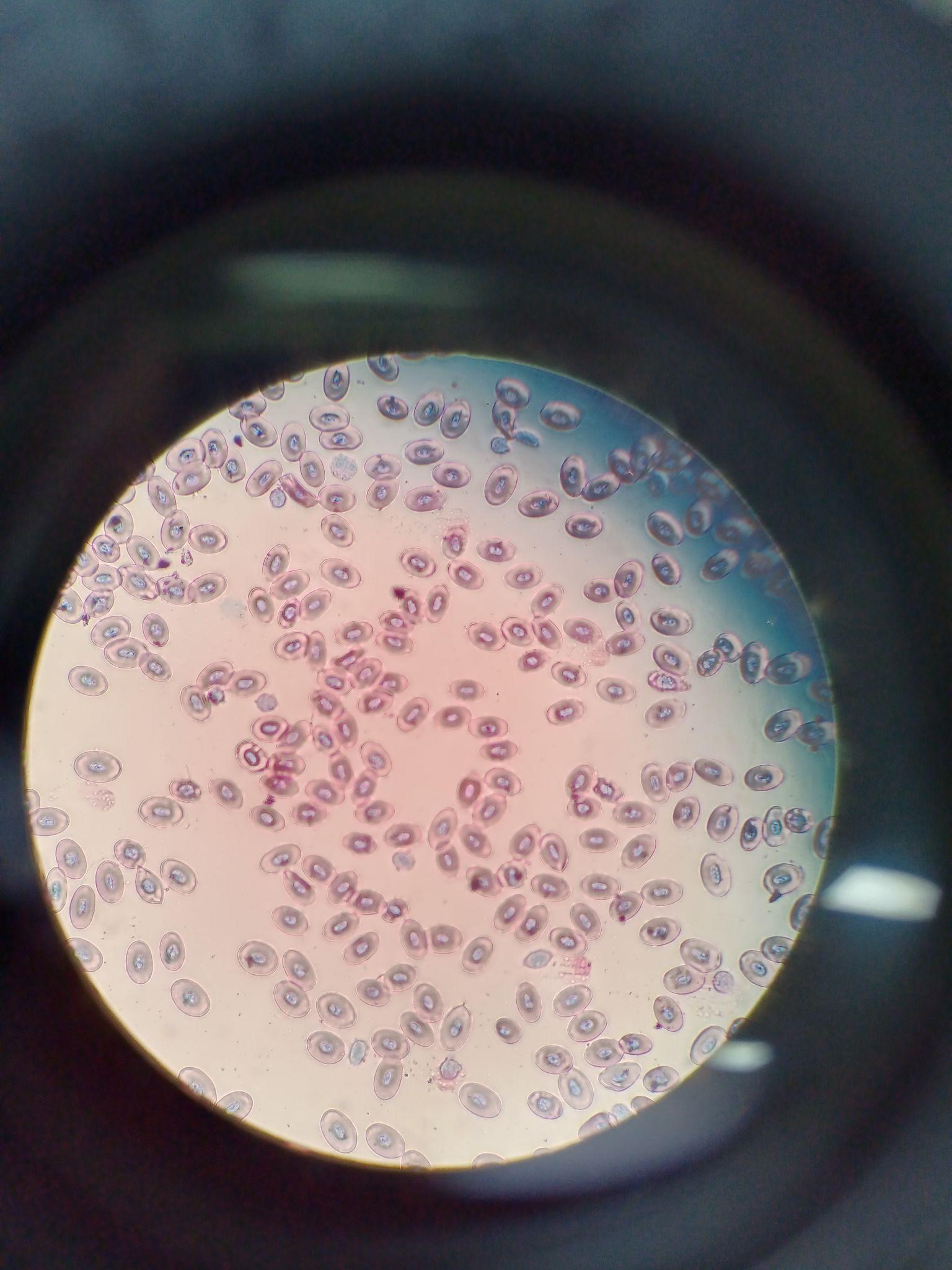 简述白细胞分化抗原及其单克隆抗体在临床上的应用? - 知乎