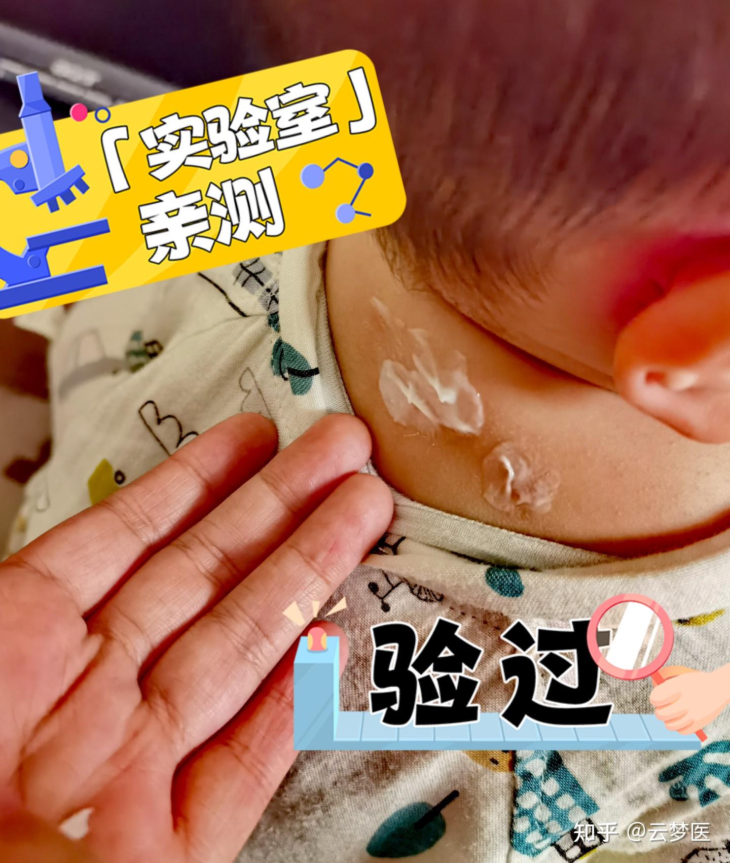 婴儿脸上湿疹是怎么引起的（婴儿为什么爱得湿疹）-幼儿百科-魔术铺