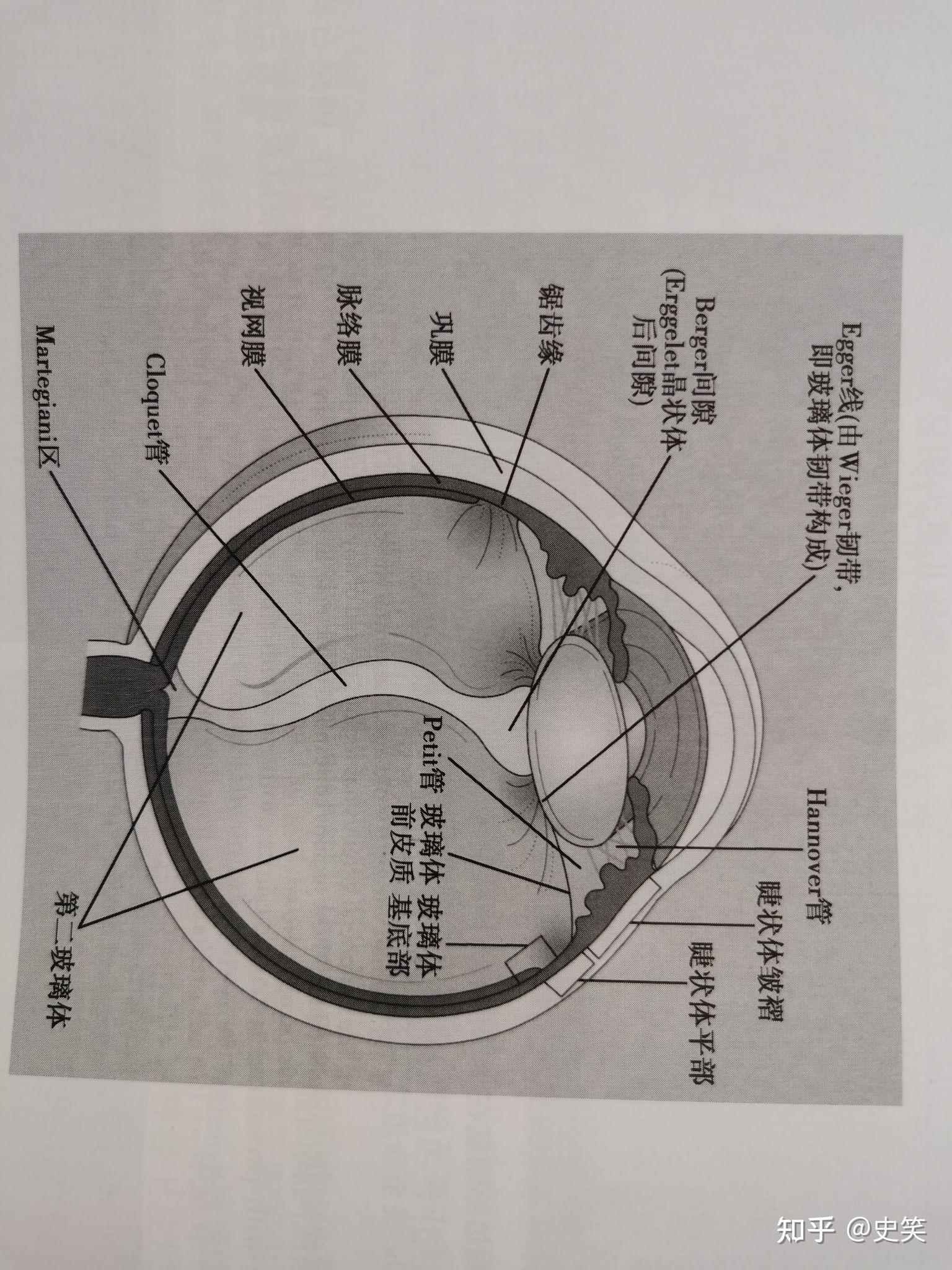 玻璃体液化怎么办