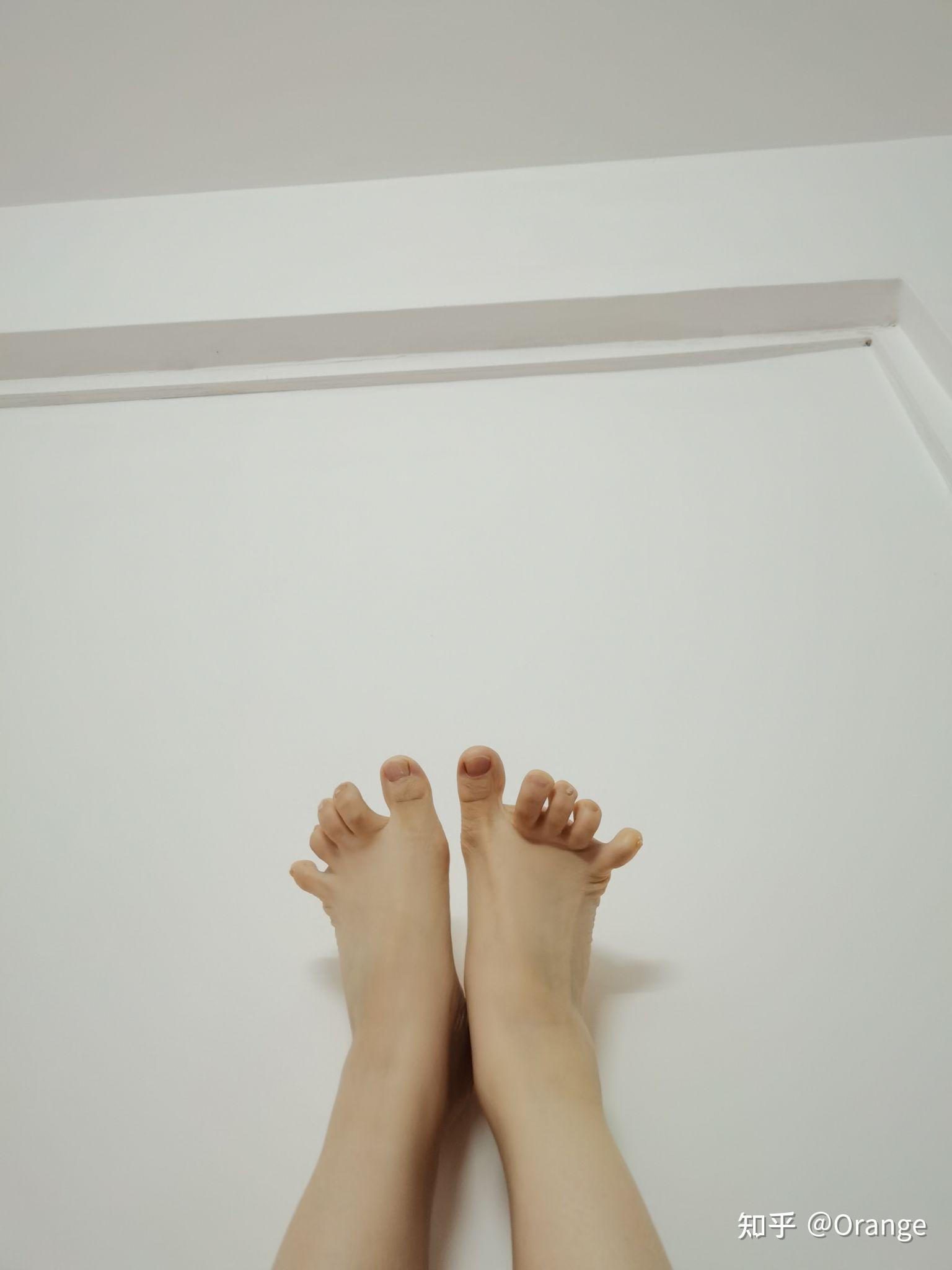 脚趾能否五指张开是基因差异吗