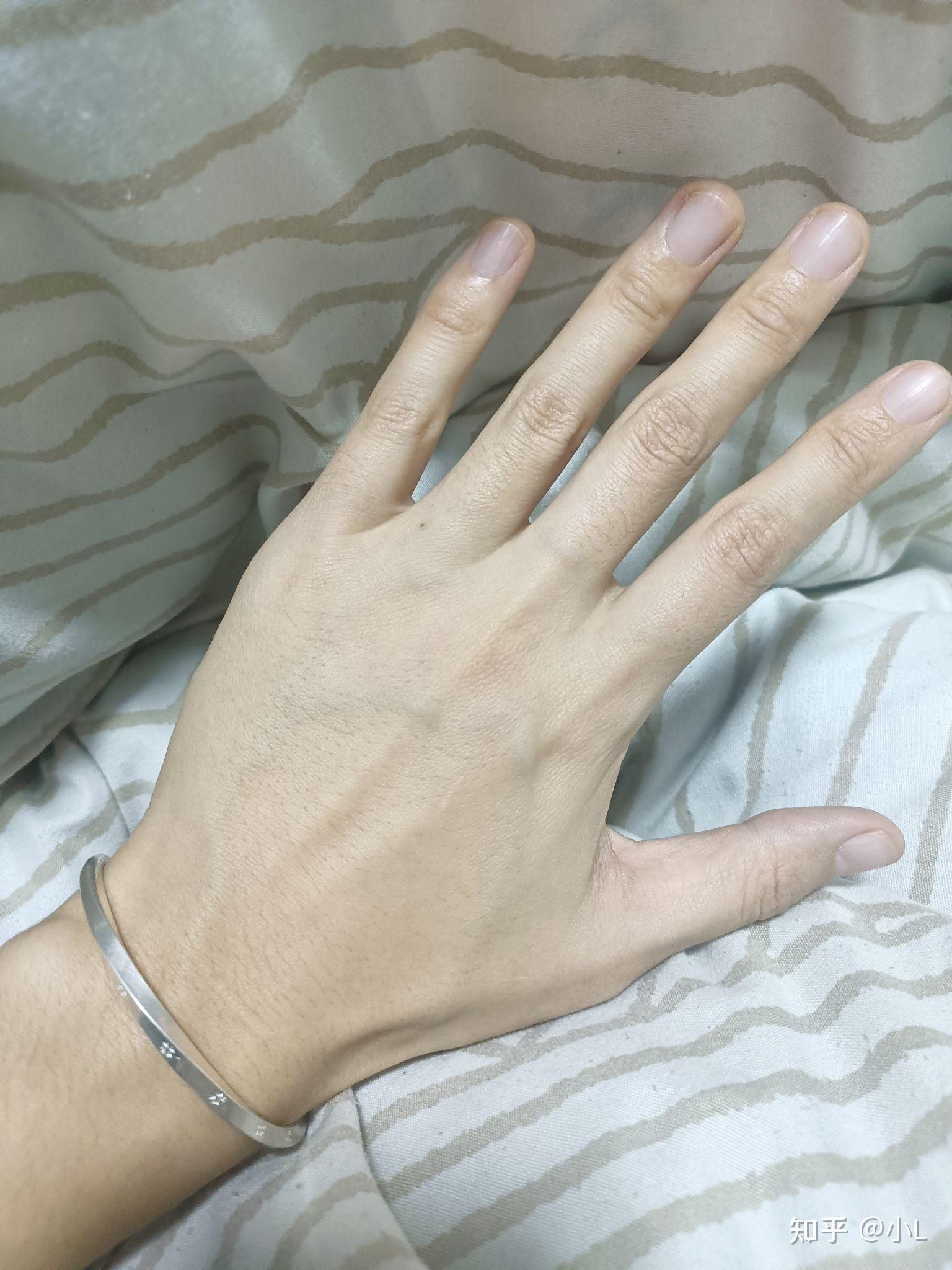 发现谈了三个月的男朋友手是这样,还应该继续谈下去吗?