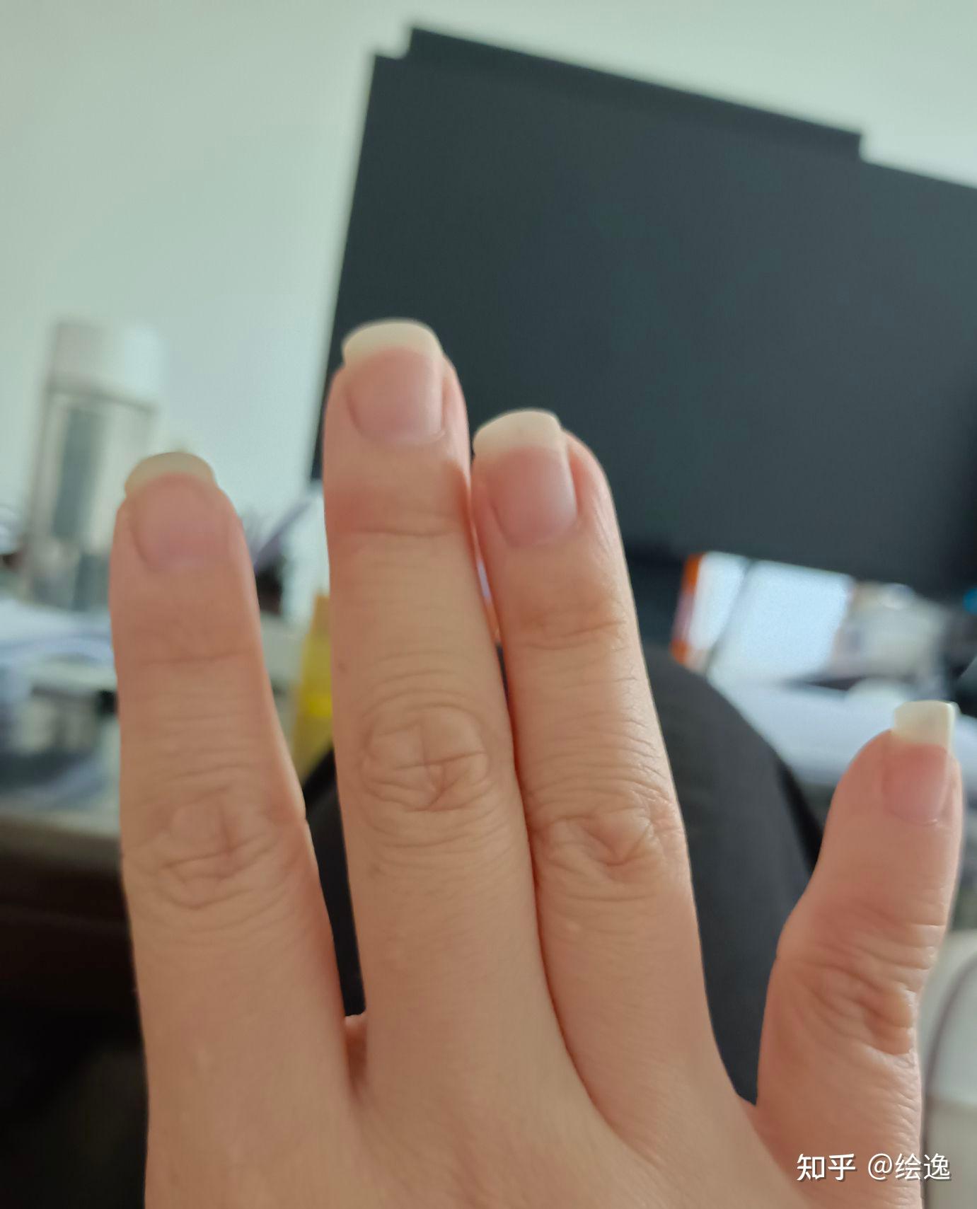 中指因为写字变形有什么方法