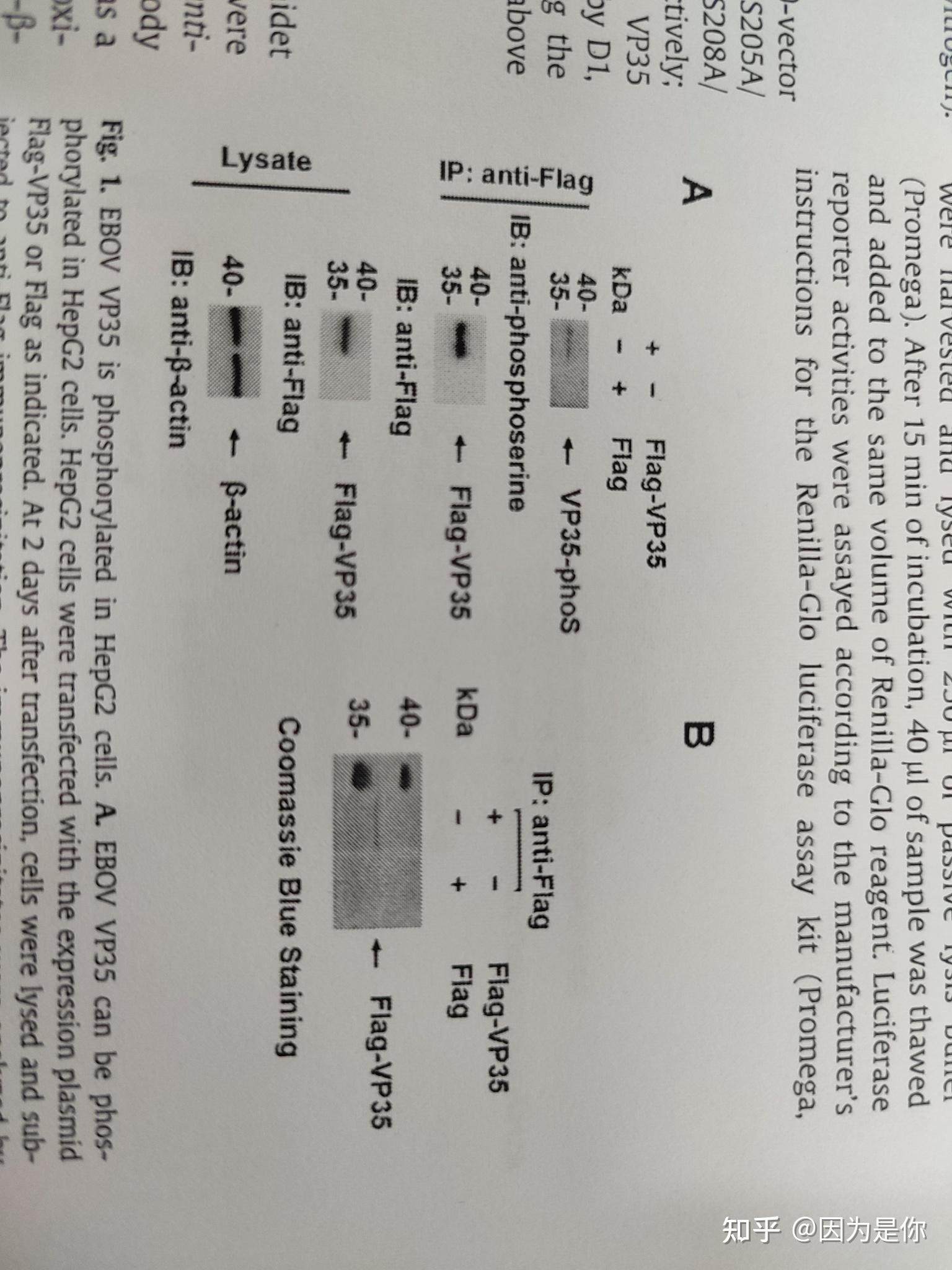 免疫共沉淀这个图有没有大佬给解答一下,看一下午了,实在没看懂? - 知