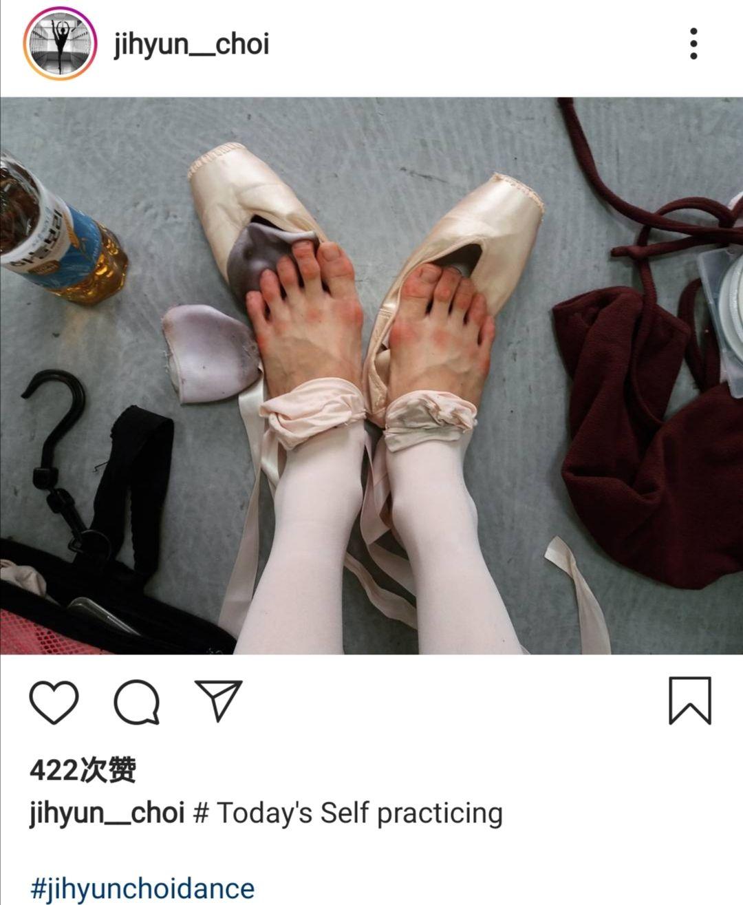 芭蕾舞演员的脚会变成什么样