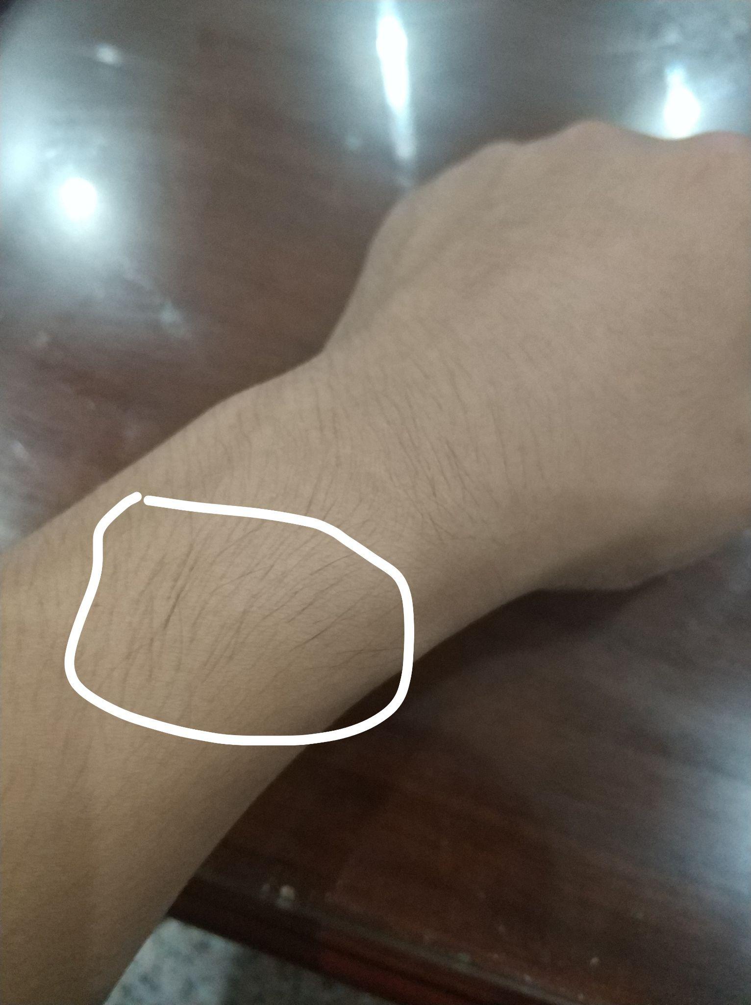 体毛是否会越刮越长？如果是，为什么？ - 知乎
