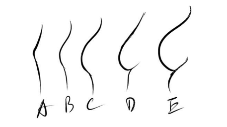 从假体隆胸260cc和280cc图片看这两个型号做出来的胸大小相差很明显