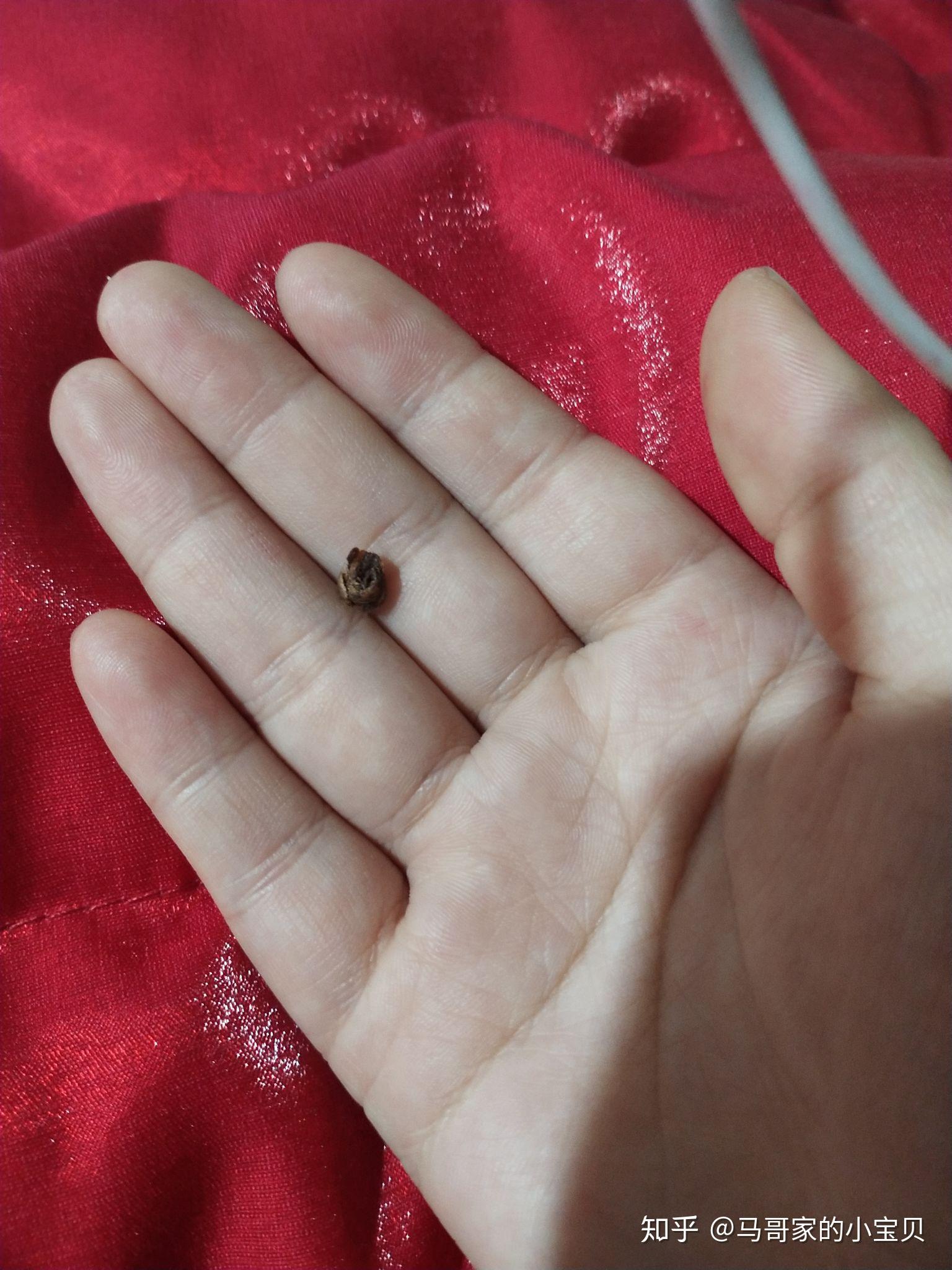 耳屎能大到什么程度? - 知乎