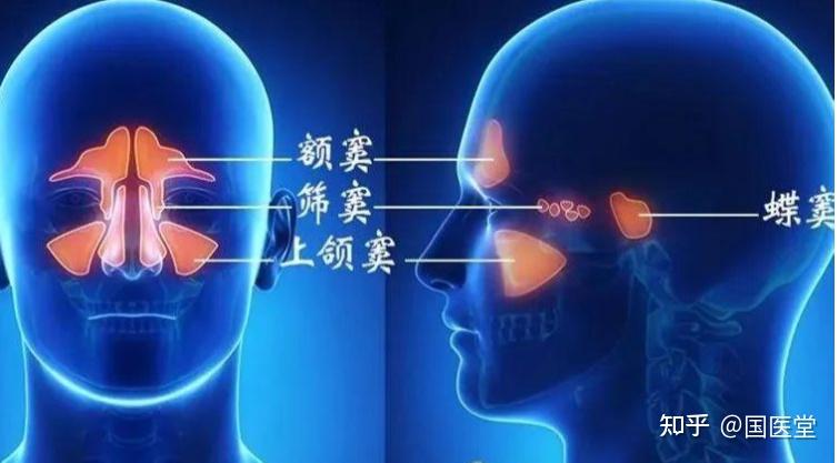 慢性鼻窦炎的起因有哪些？ 知乎 