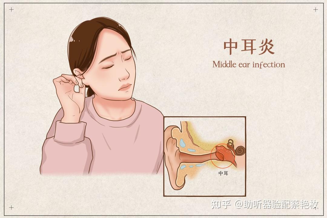 耳朵里面痛好像是发炎了怎么治疗