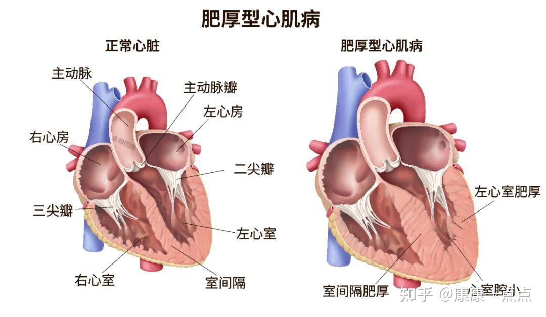 心肌位置图片图片