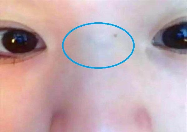 宝宝闹人不好带,是因为鼻梁有"青筋"?别乱信,真正原因是这些