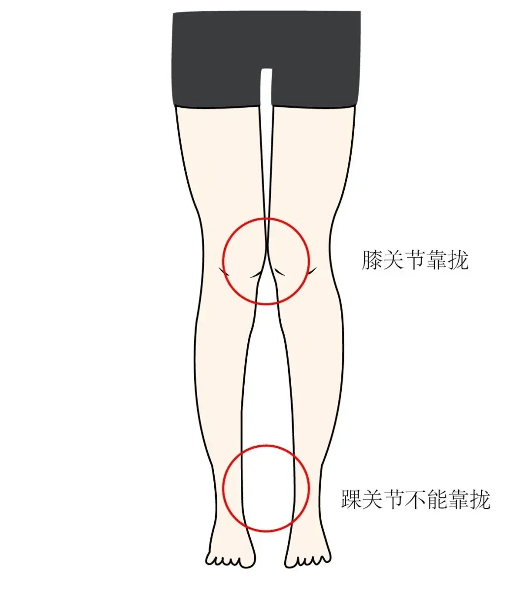 膝蓋嚴重內扣小腿外翻怎麼改善