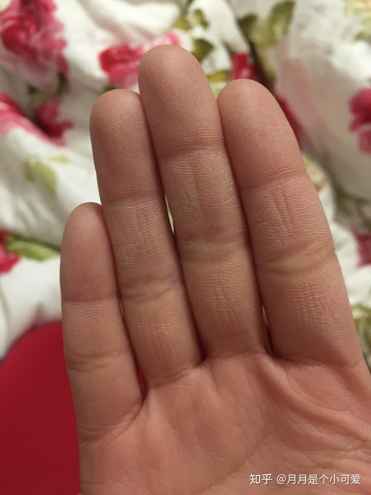 手掌很硬很粗糙怎么办,已经勤擦手霜也有做手膜,还是干涩硬粗糙,感觉