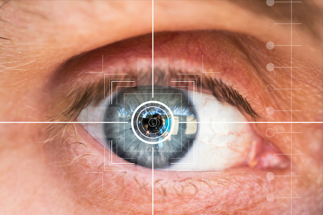 视网膜裂孔做了修复激光光凝术,是以后都不可以运动吗? - 知乎