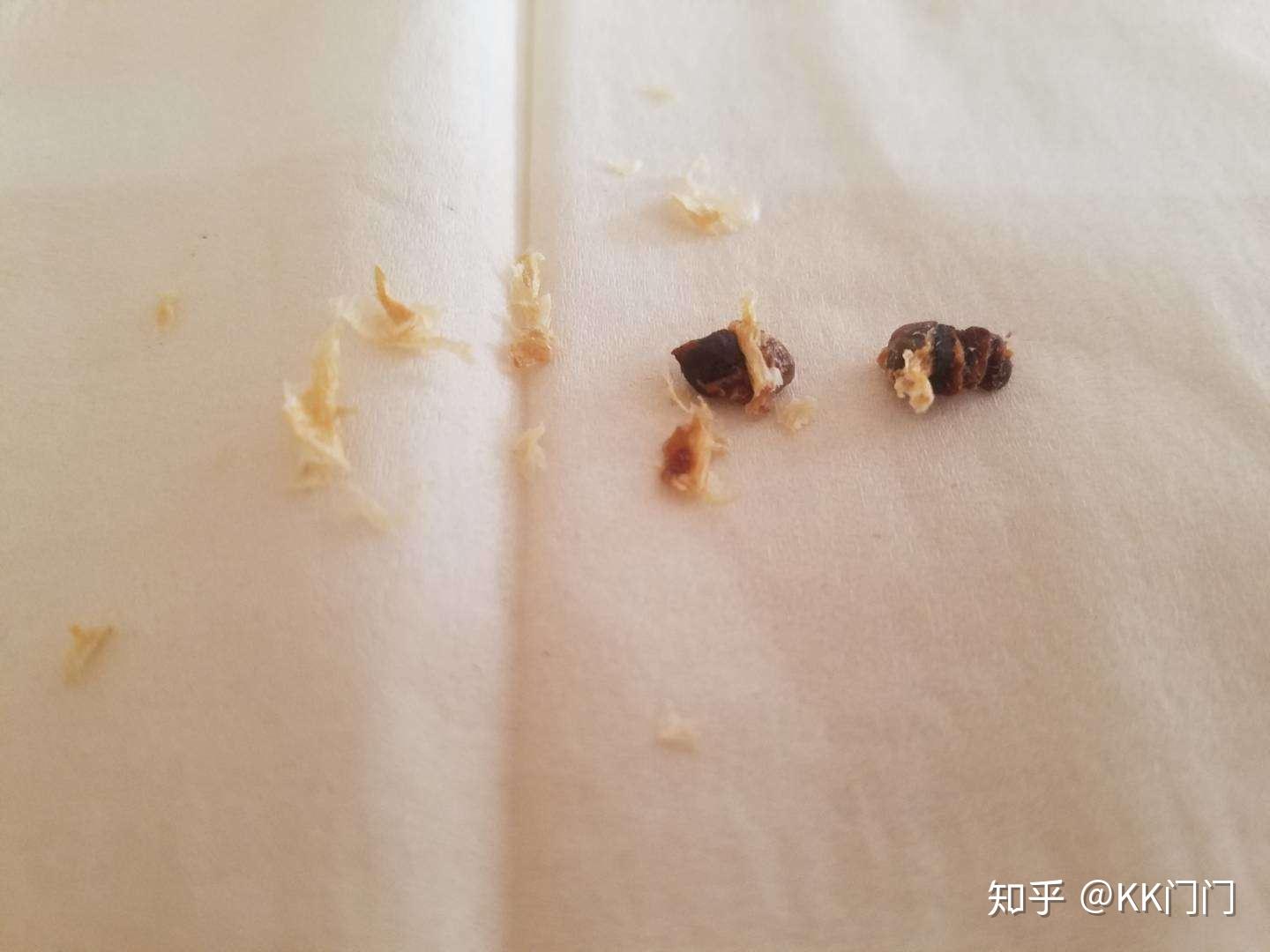 耳屎能大到什么程度