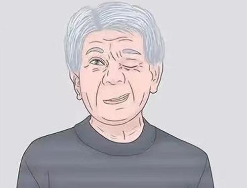 面肌痉挛强度分级标准来了,到哪一级需要做手术?