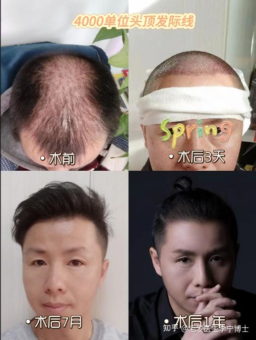 发缝明显 有什么办法吗? - 知乎