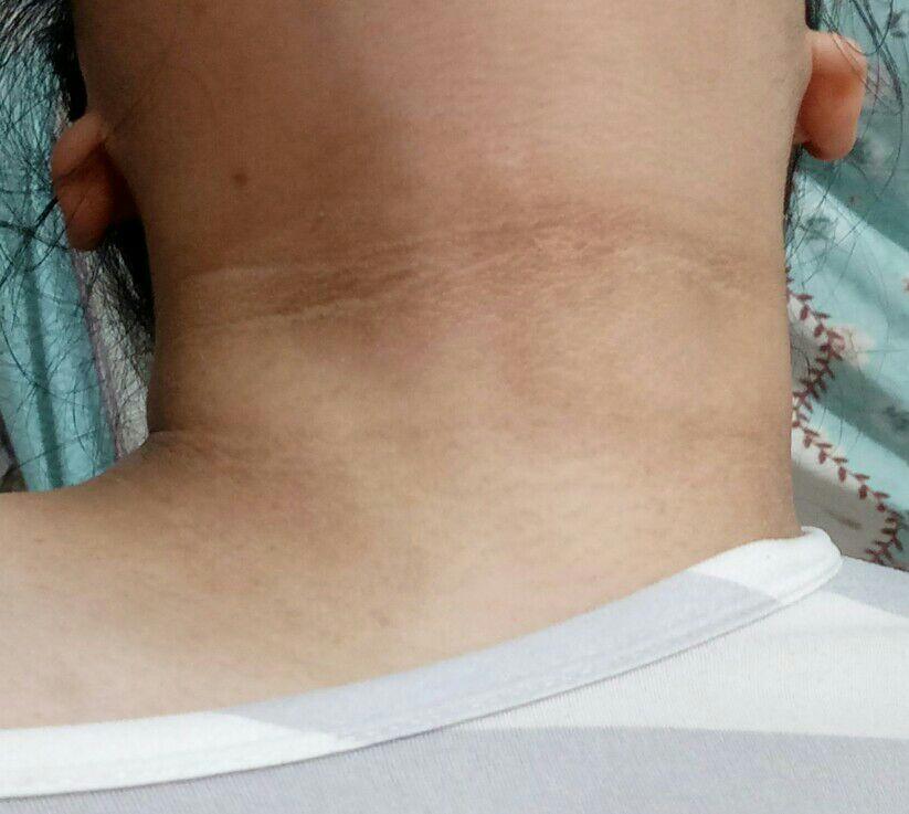 黑棘皮女孩是不是可以准备孤独终老了? - 知乎