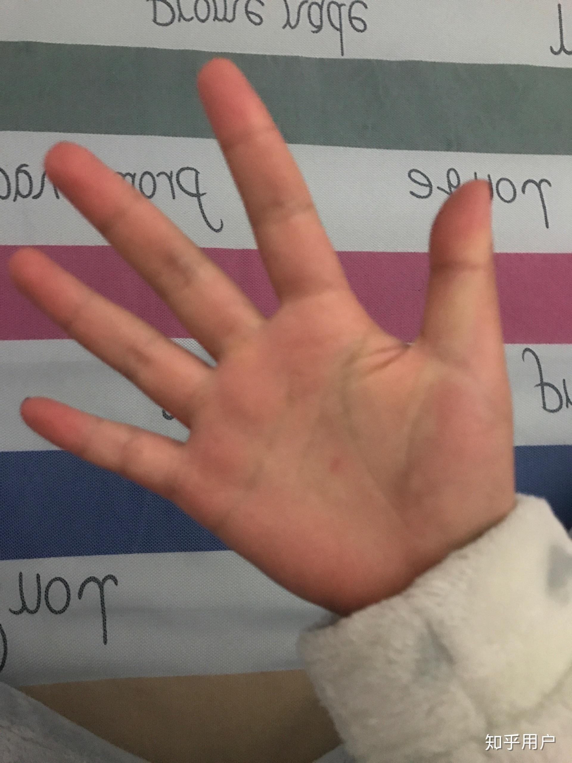 手长的难看是种怎样的体验