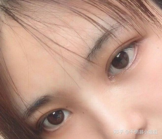 看到最近流行割小平扇双眼皮小平扇是属于什么形状它和平扇开扇区别在