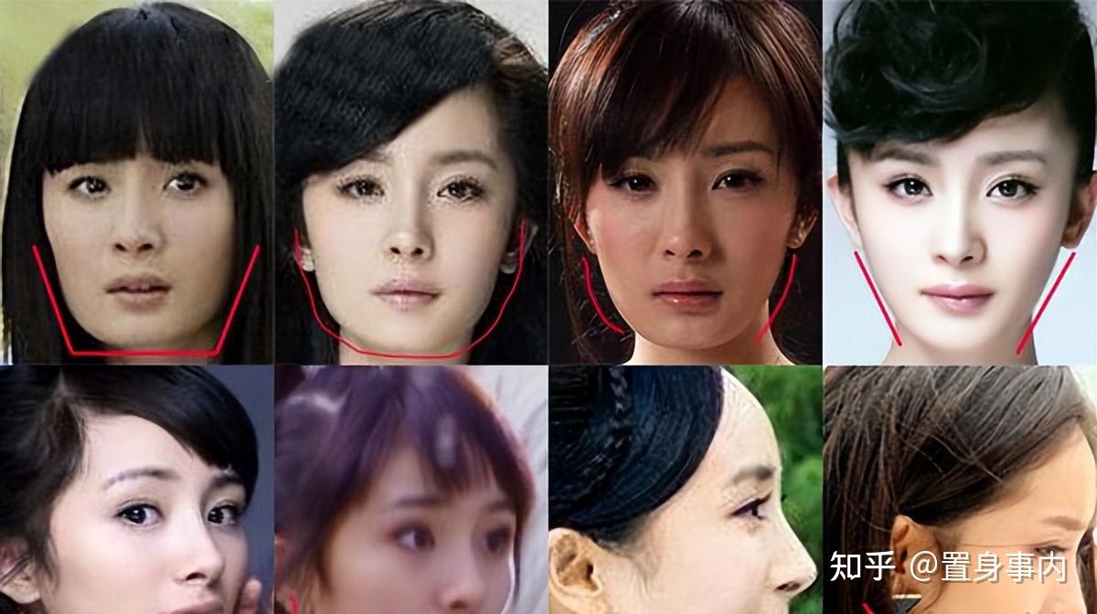 整容成功的明星案例都有哪些