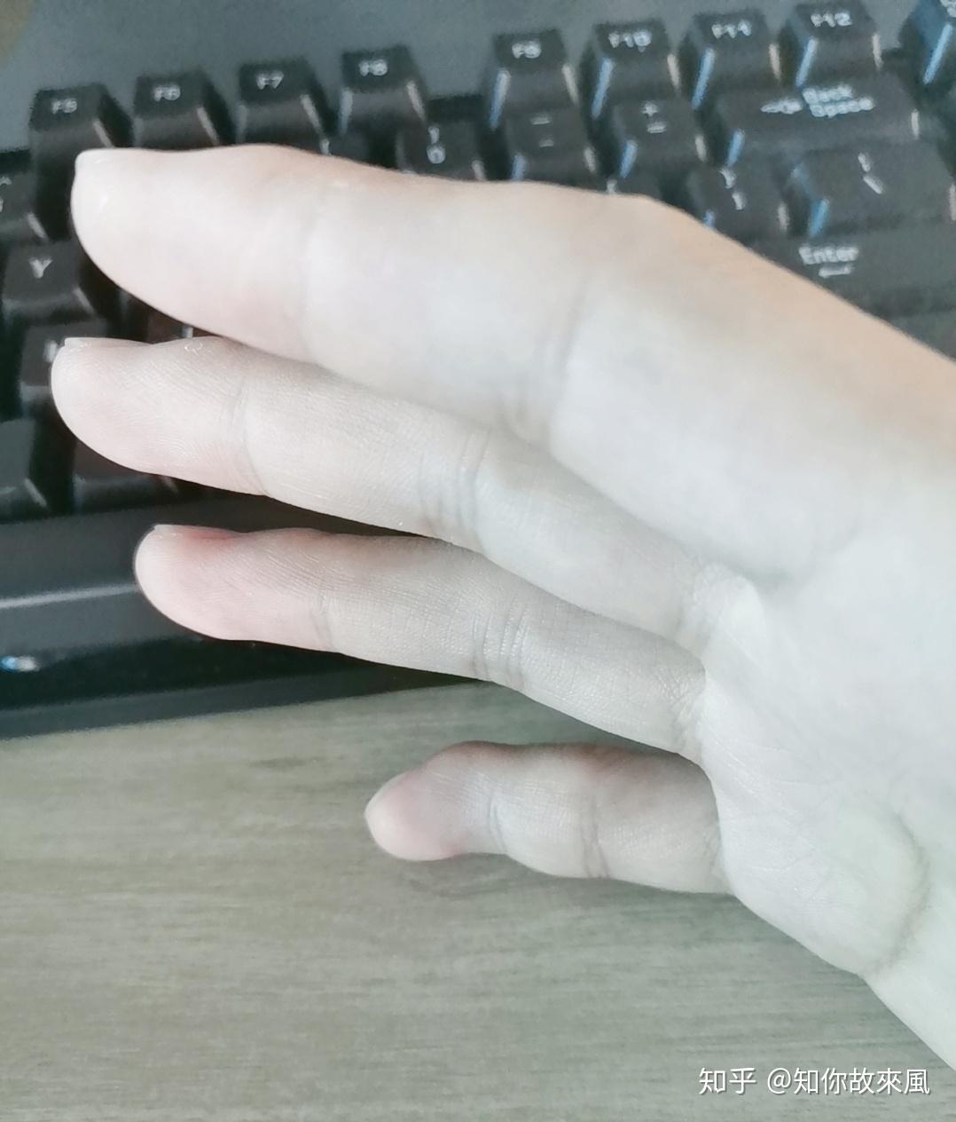为什么小拇指是弯的? ?