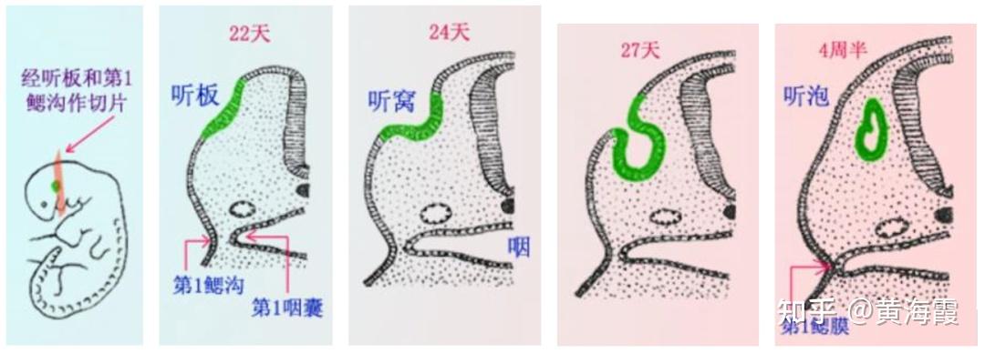 孕期——耳朵结构发育是怎样形成呢? - 知乎