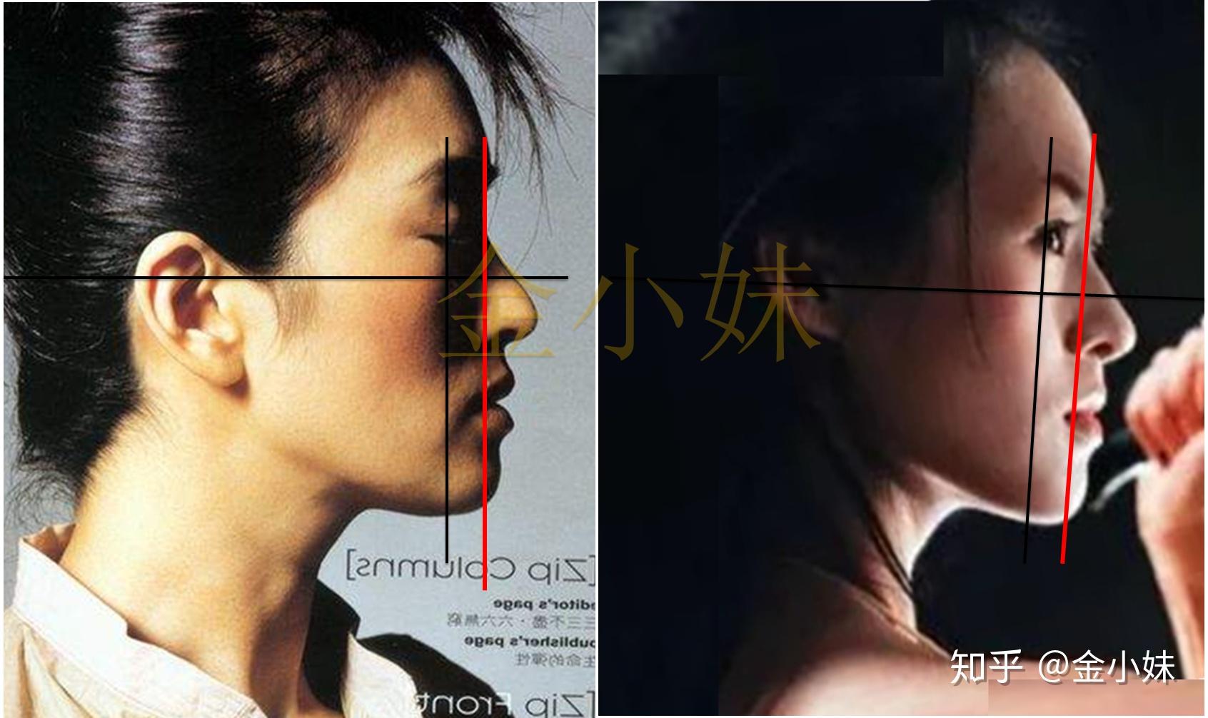 有哪些明星有颌面问题？比如地包天？ - 知乎