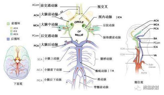 颅内动脉环解剖图图片