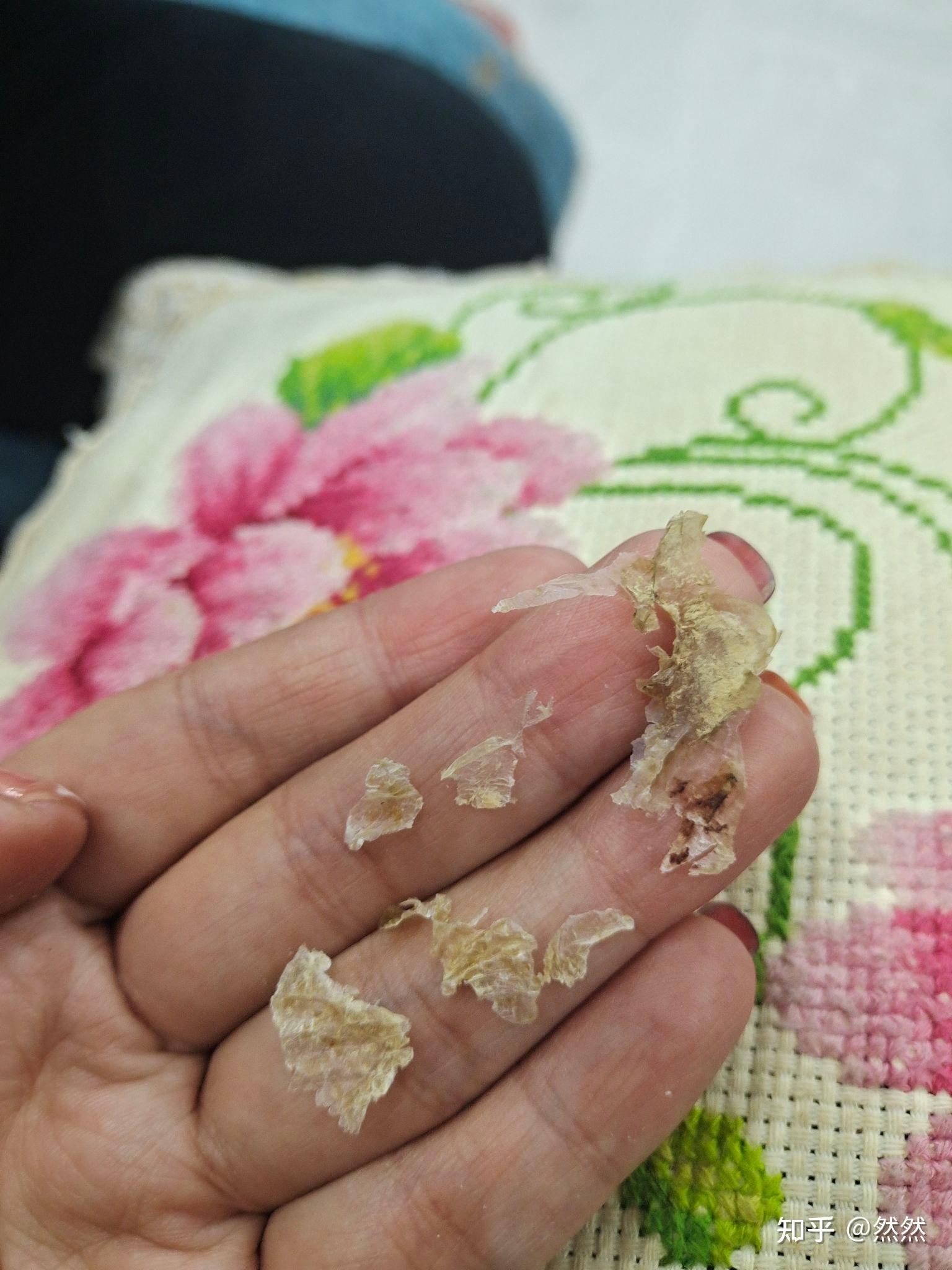 你们掏出来的耳屎有多大?