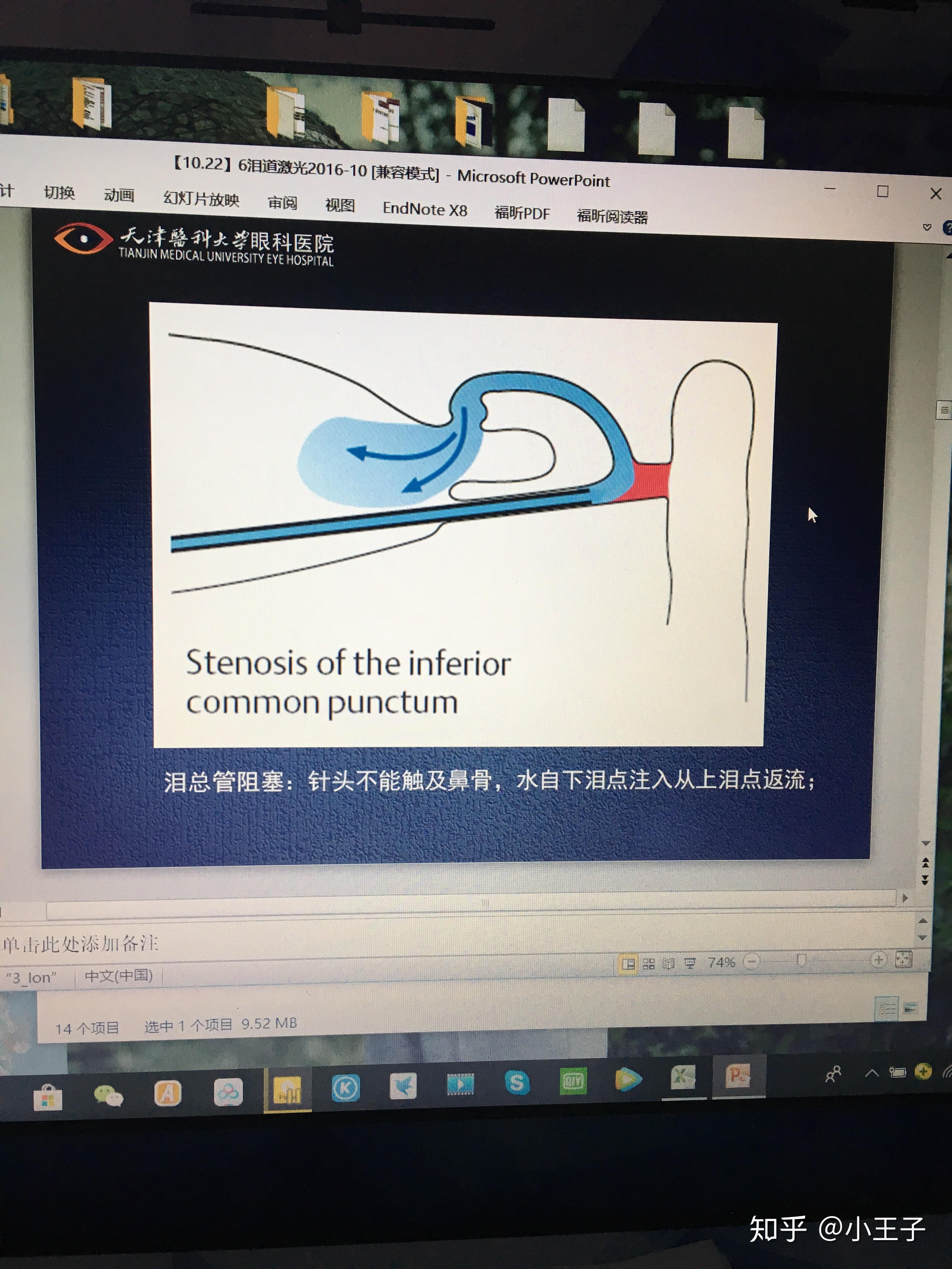 眼科术前冲洗泪道的手法如何判断冲洗结果下图怎么看