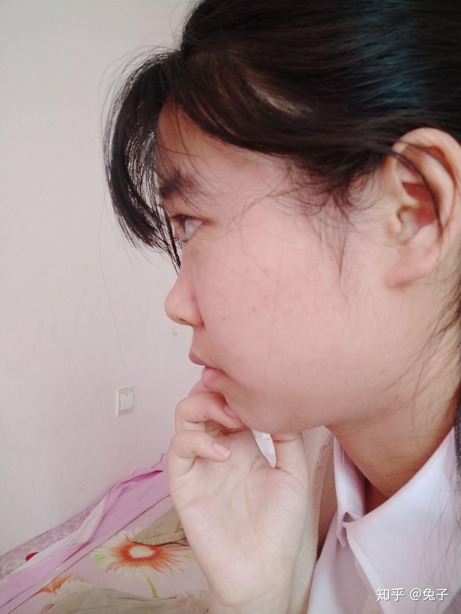 没有鼻梁,鼻子塌的人是什么体验? - 知乎