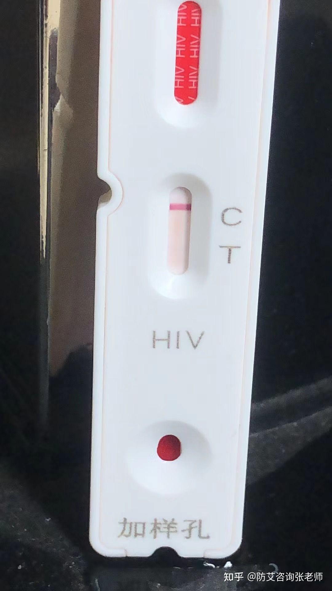 hiv弱阳图片