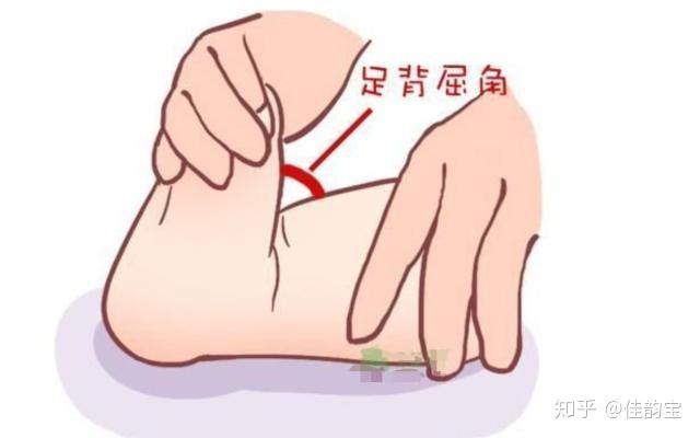 婴儿肌张力高的表现是什么?