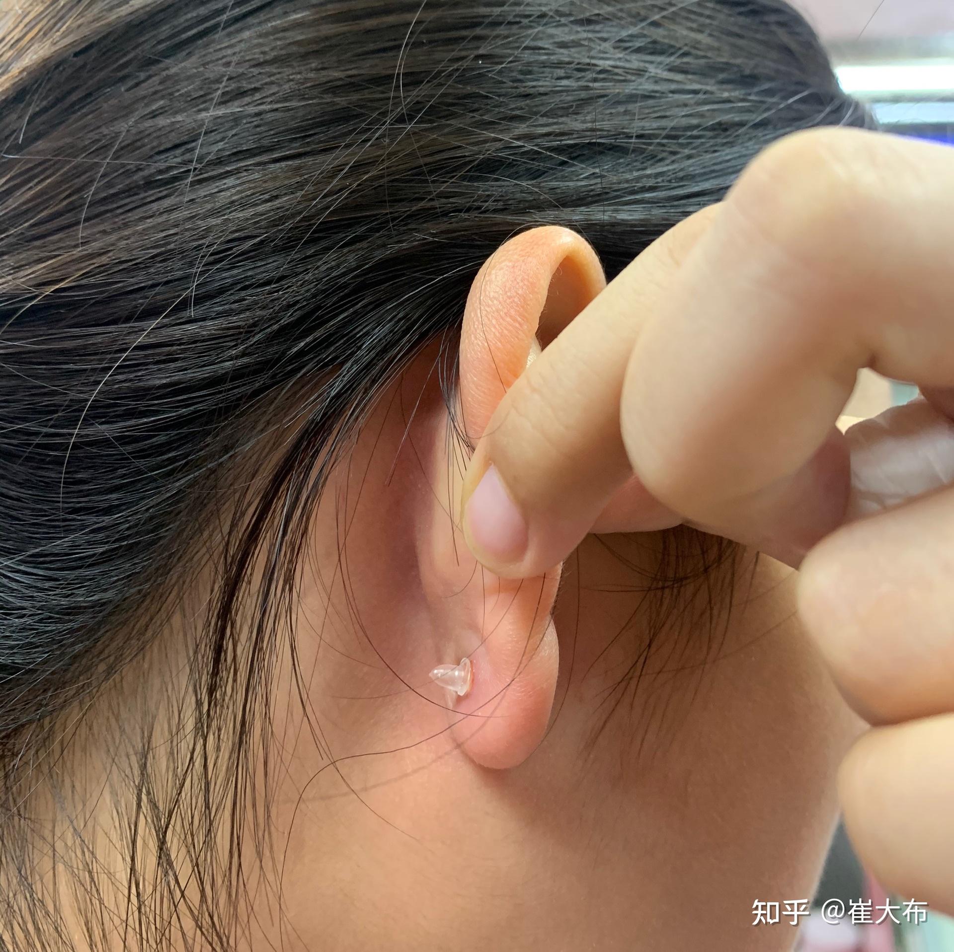 厚耳垂打耳洞是一种什么样的体验会很疼吗