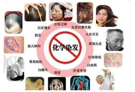 白发的人都会选择染发来使其变黑,膜玲珑:大可不必 - 知乎