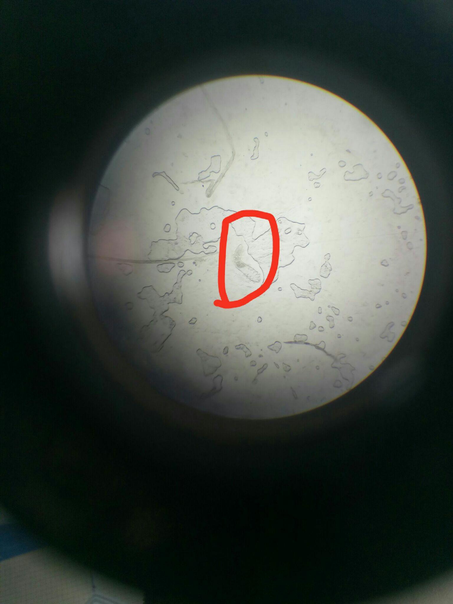 脸上的螨虫应该怎么办?