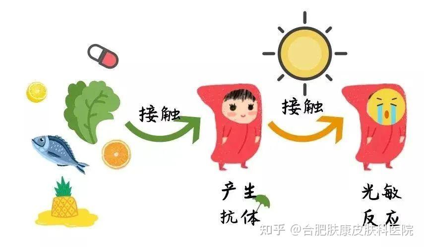 皮肤对“阳光”过敏?紫外线导致的这种皮肤病要小心! - 知乎