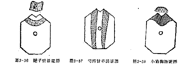 中医进阶学习——腹诊精华总结 - 知乎