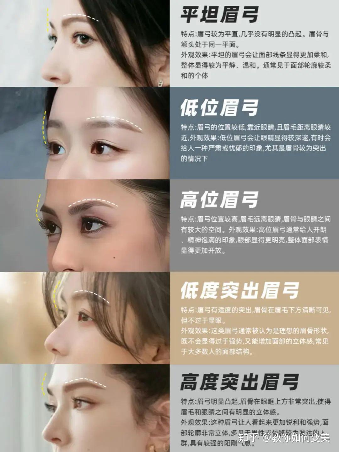 有人做过眉弓填充手术吗? - 知乎