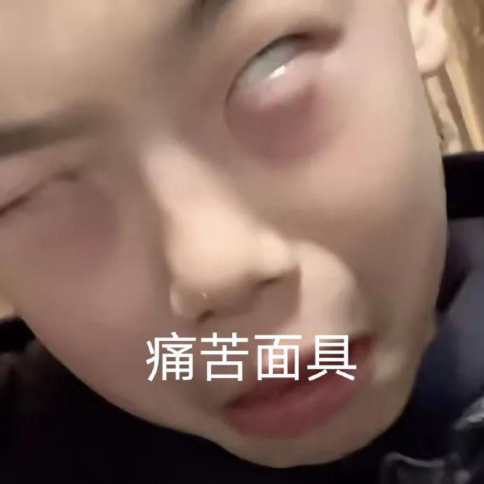 谁有抖音张典的表情包啊啊啊跪求