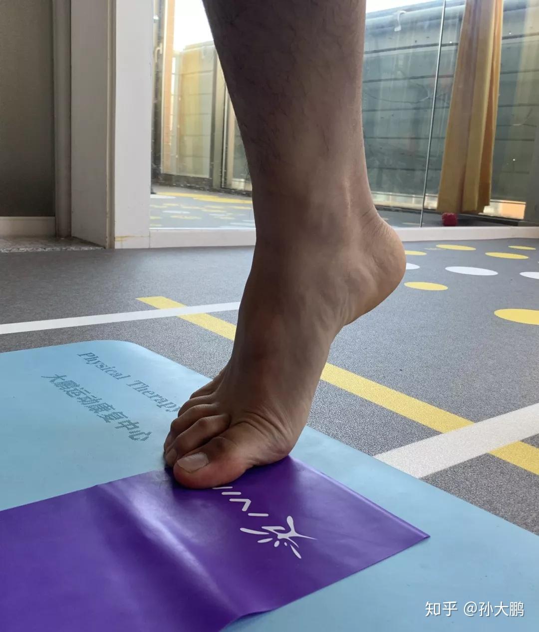 如何有效矫正扁平足?