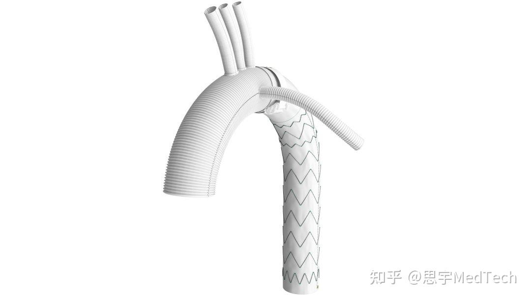 全球首创！华脉·心岸®一体式人工血管术中支架系统获批 - 知乎