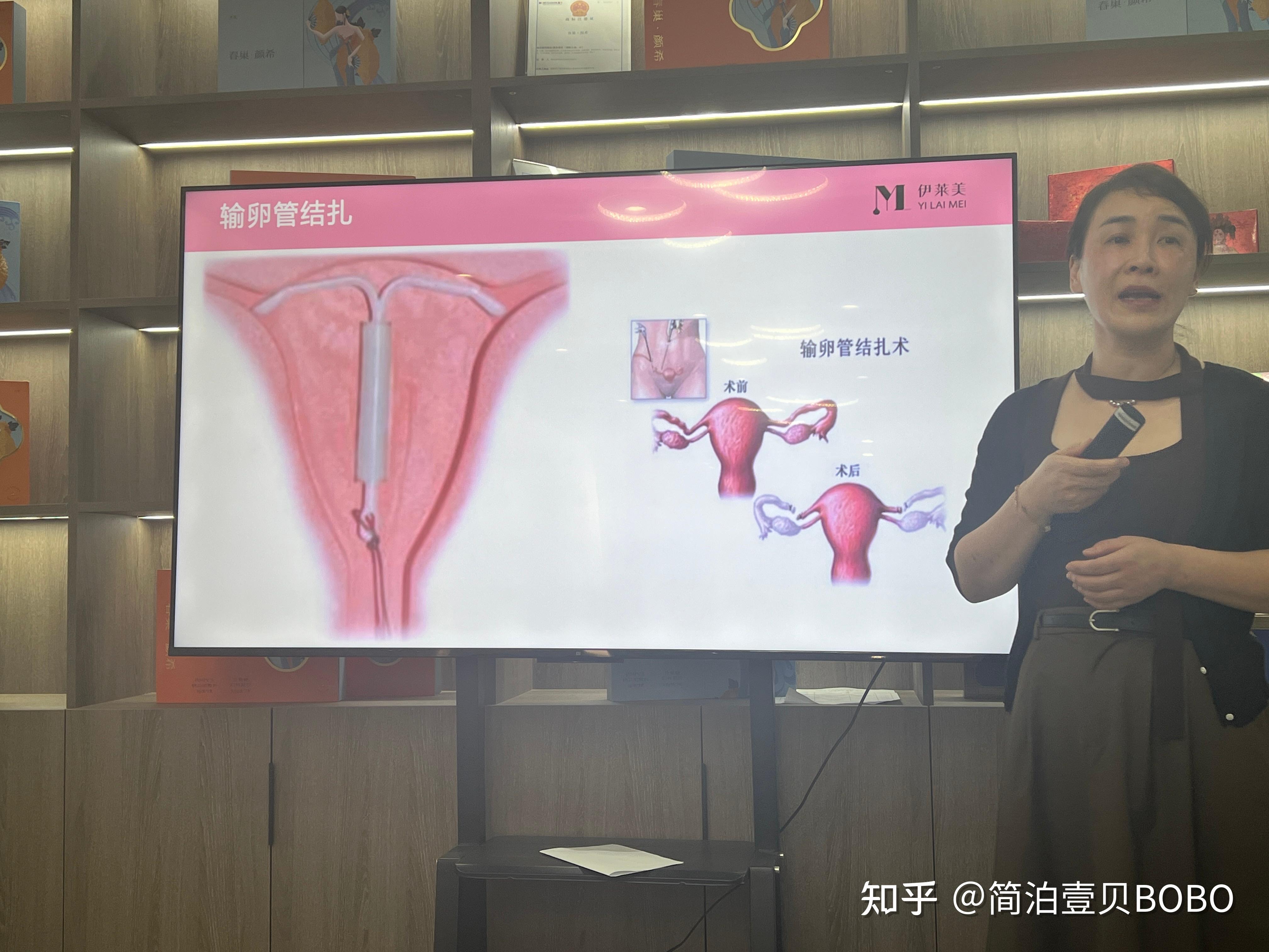 宫腔粘连的症状有哪些? - 知乎