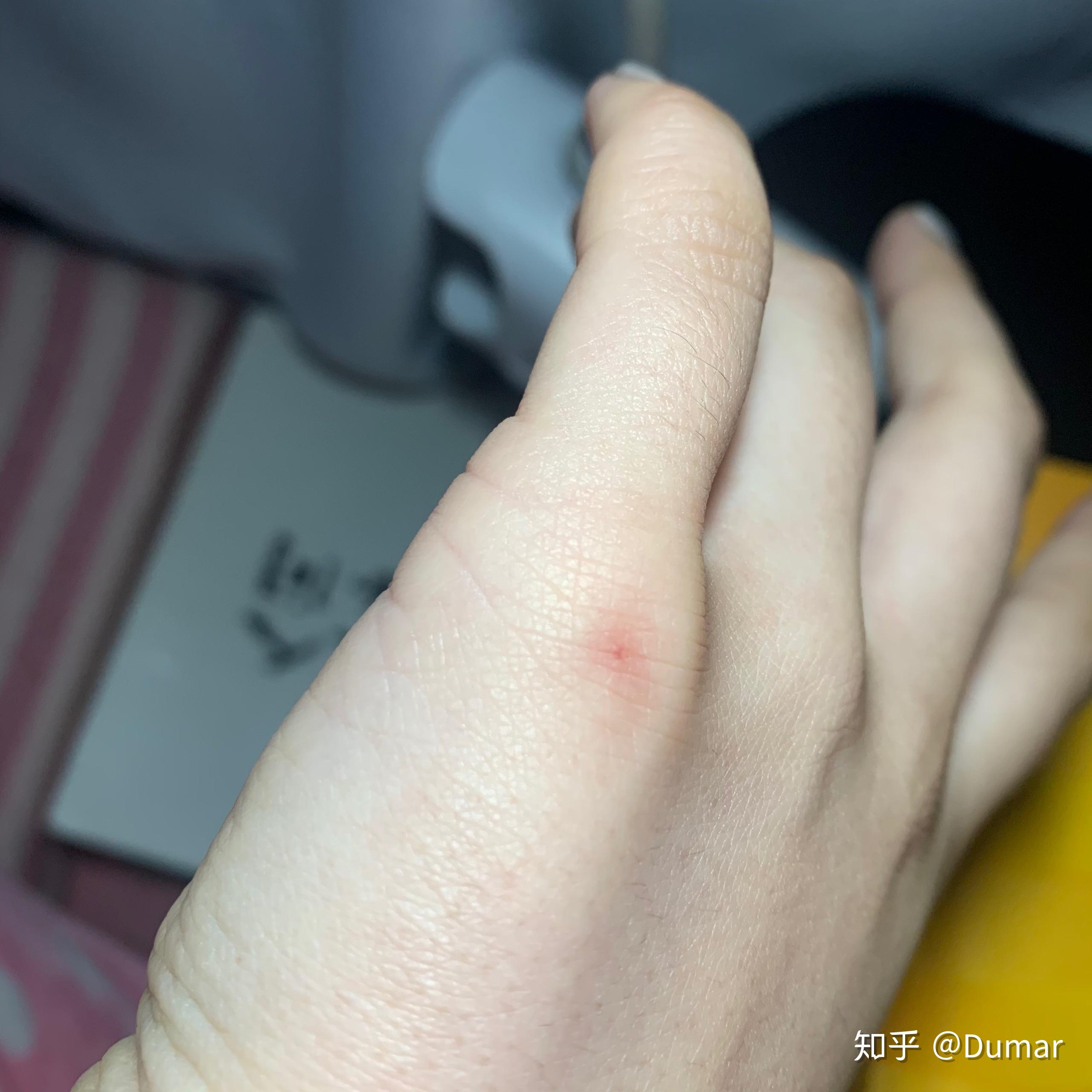 真的有人会有朱砂痣吗? - 知乎
