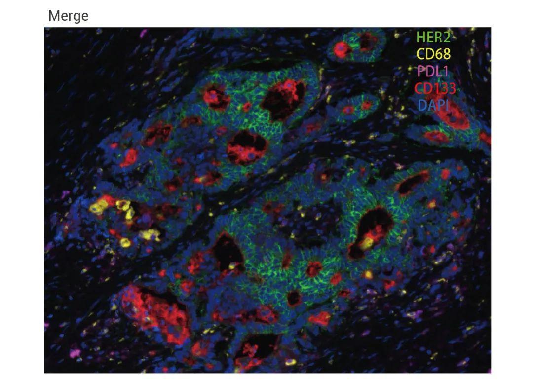 多重荧光免疫组化技术 (mIHC) 的原理什么，与 IHC 和 IF 有何区别？ - 知乎