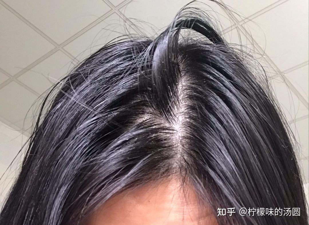 头发油的快且掉发今天洗明早上就特别油怎么破