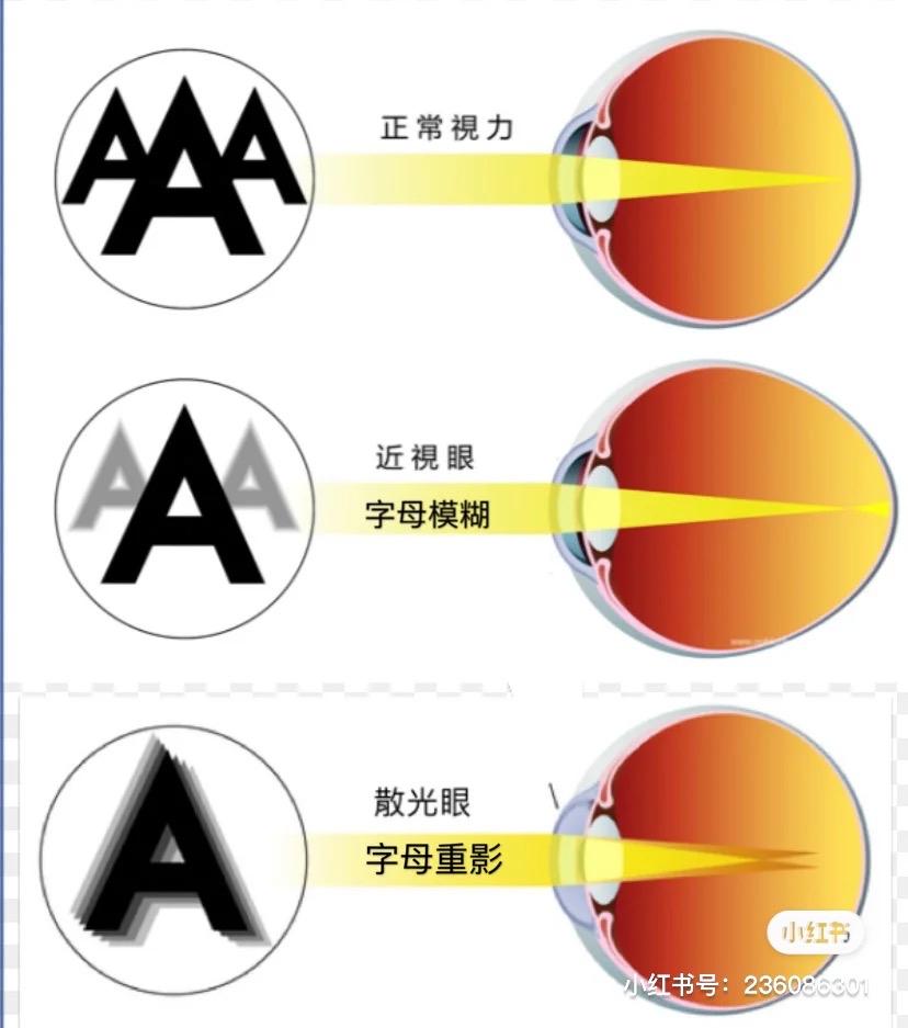 散光看東西是什麼樣的