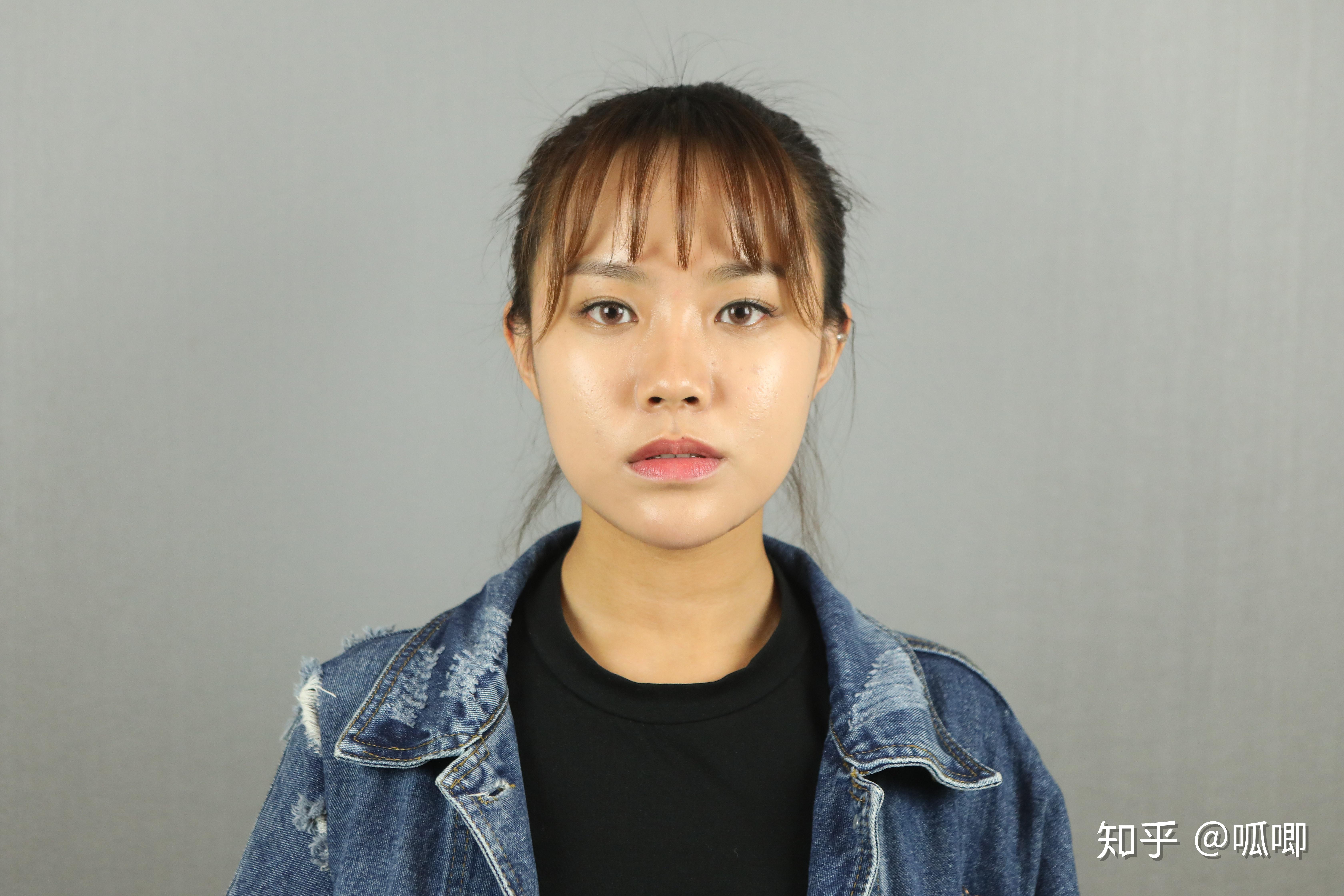 单纯隆鼻可以提高颜值吗? - 知乎